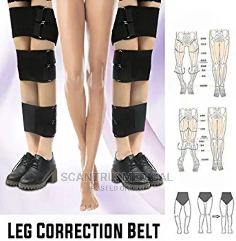 Leg Correction Brace Belt Knock Knees in PortHarcourt Medical